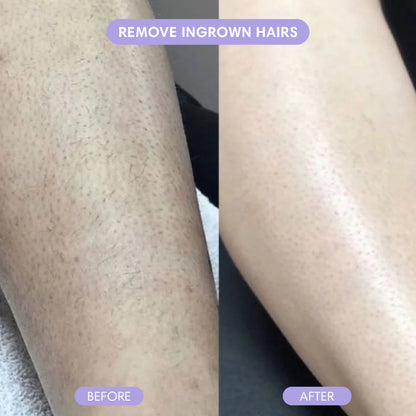 Shave armpits, legs, face and bikini area - without painful waxing or razor cuts ever again!