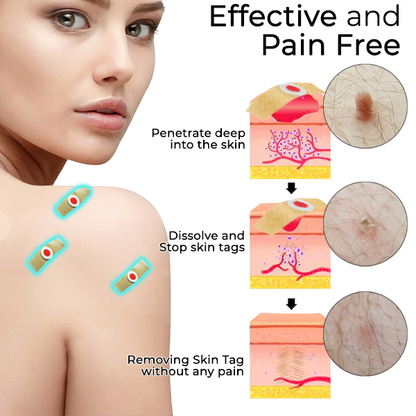 Fivfivgo® Skin Tags & Mole Aftercare Protecting Patch PRO